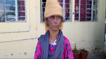 उत्तराखंड में यहाँ हैवानियत तसवीर: बहू को गर्म तवे से जलाते थे ससुरालीजन, चिल्लाती तो मुंह में ठूंस देते थे कपड़ा, नहीं देते थे खाना।