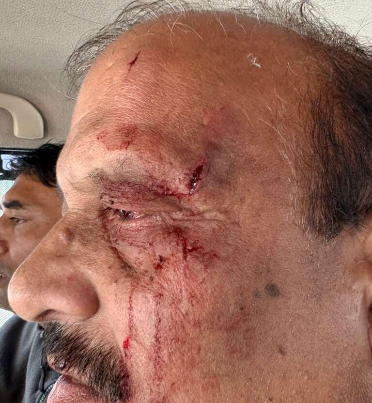 उत्तराखंड के निदेशालय में संग्राम, शिक्षा निदेशक पर हमला से मचा भूचाल।