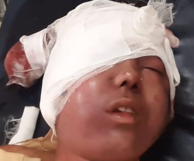 उत्तराखंड में रानीखेत के जंगल में युवती पर गुलदार का हमला, गंभीर हालत में अस्पताल में भर्ती।